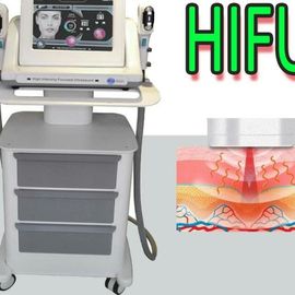 HIFU-Schönheits-Maschine für Haut-Verjüngung
