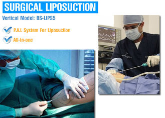 Körper-chirurgische Fettabsaugung formend, bearbeiten Sie dünne Maschine Lipo für Chin/äußere Schenkel maschinell
