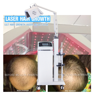 Laser-Therapie der Haar-Therapie-LLLT wachsen Haar mit wirklicher Dioden-Laser-Haar Regrowth-Maschine