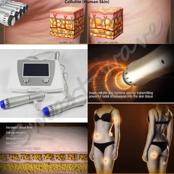 Starker akustischer Druckwelle Cellulite Therapieausrüstung mit Ultraschallhohlraumbildung CER verringern